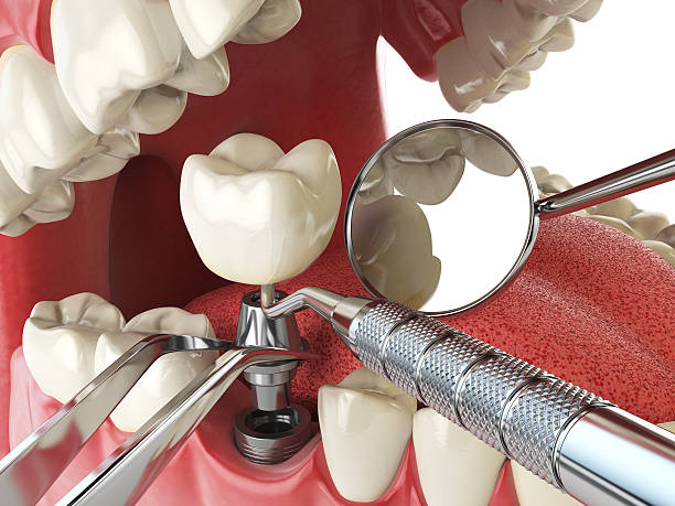 Best Emergency Dental Care for Sports Injuries in Waynesburg, OH